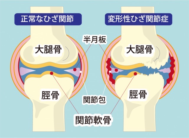 膝関節の中の図