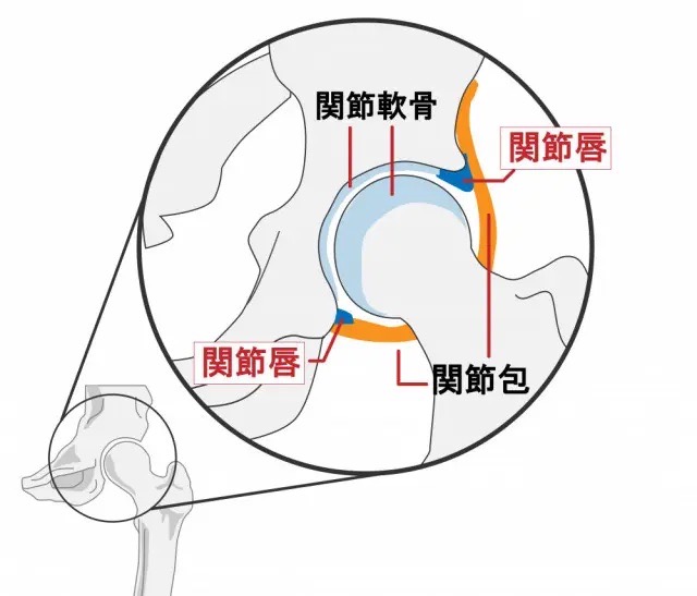 股関節の構造図解イラスト