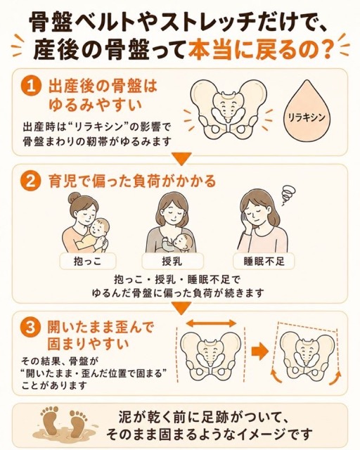産後の骨盤がゆるみや育児の負担によって歪んだ状態で固まる仕組み